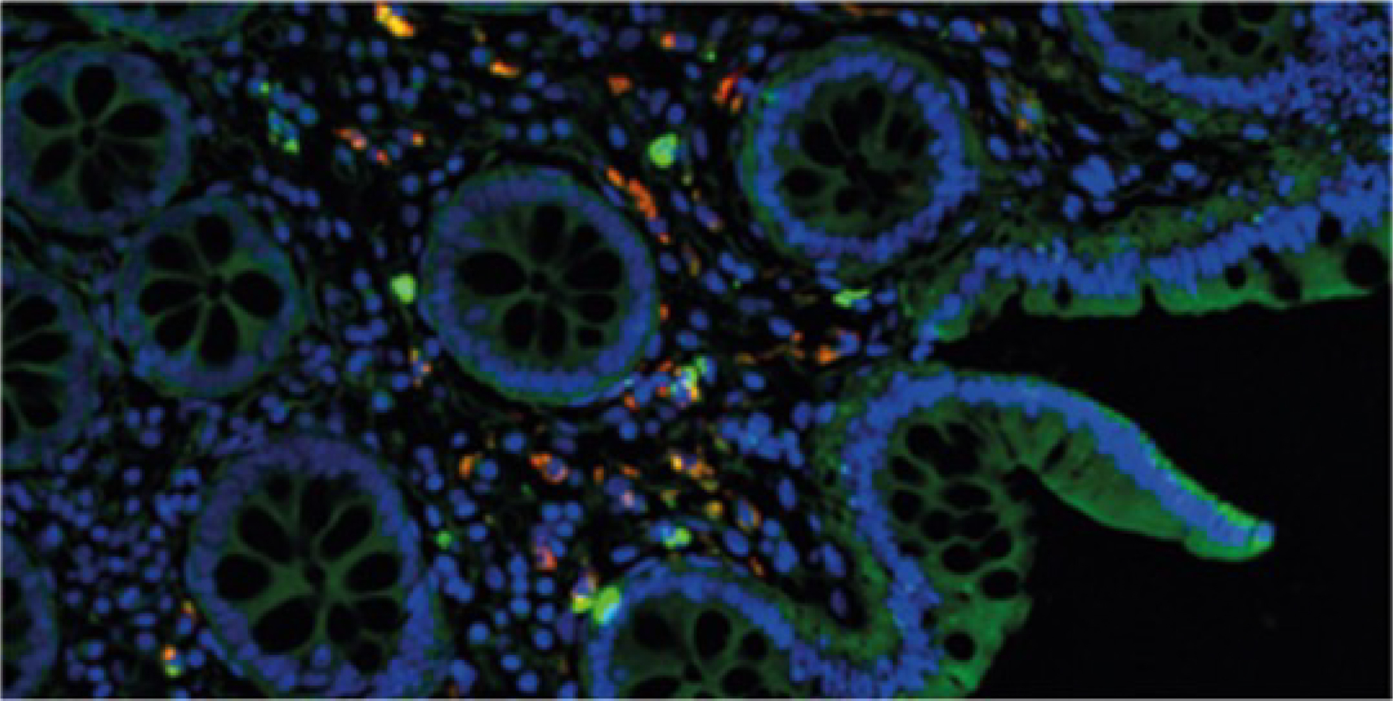 Fluorescentiemicroscoo_Vision