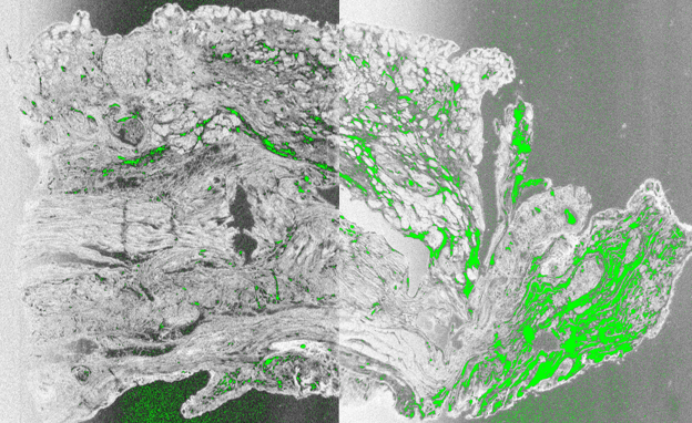 OCT_Histology