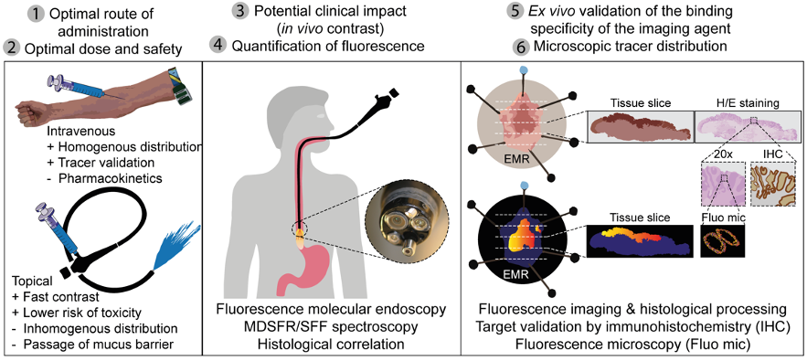 Fluorescence molecular endoscopy | OMIG