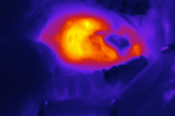 Fluorescence guided head and neck surgery | OMIG