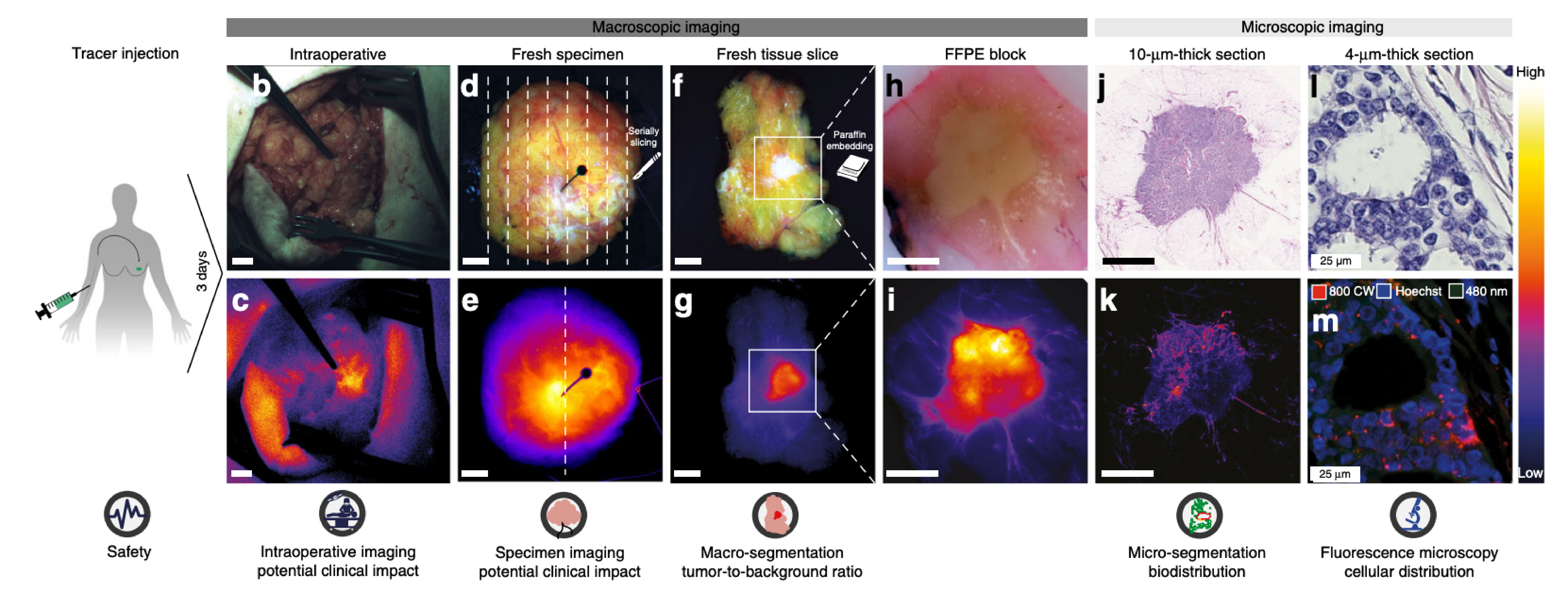 Fluorescence guided mamma surgery | OMIG