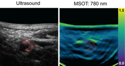 Multispectral optoacoustic tomography | OMIG