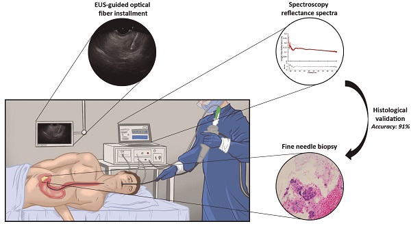Fluorescence guided endoscopy | OMIG