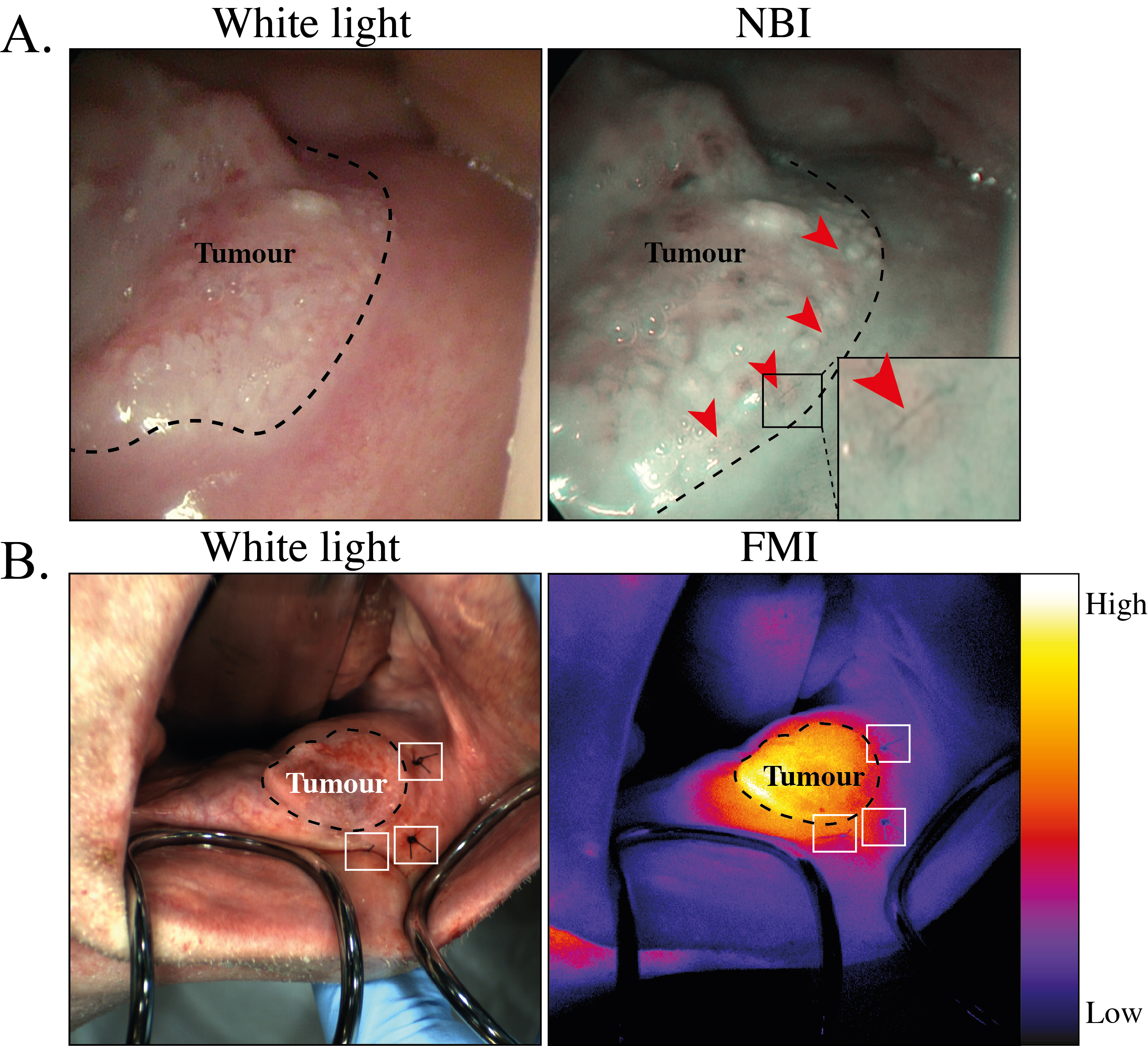 ICON in vivo NB and FMI | OMIG