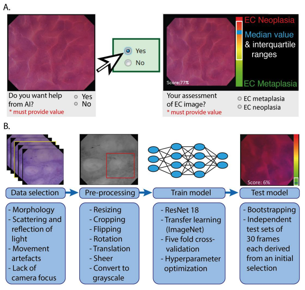 Overview of display of output of CNN architecture.